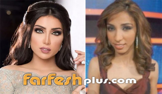 صورة رقم 1 - صور نجمات عربيات قبل وبعد عمليات التجميل بينهن أصالة وياسمين صبري! هل تبدلت ملامحهن؟