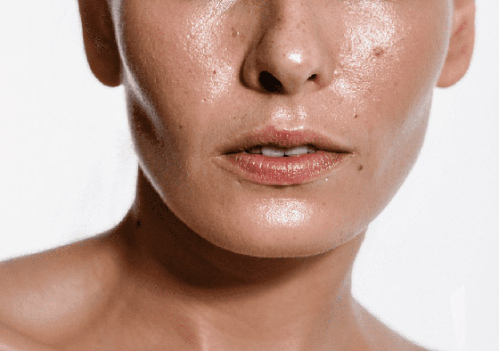  صورة رقم 5 - إليك كيفية إزالة الزيت من الوجه بسهولة لبشرة دهنية نظيفة وصحية