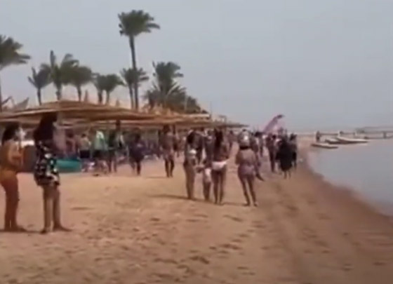  صورة رقم 3 - فيديو: سمكة قرش تهاجم فتاة مصرية في دهب.. بتر ذراعها بالكامل وحالتها خطيرة!