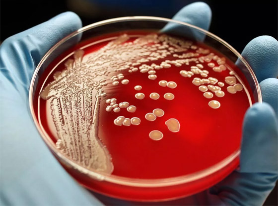 البكتيريا الخارقة.. مرض يهدد بقتل الملايين سنويا بحلول 2050 صورة رقم 2