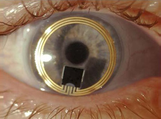 عدسات لاصقة تراقب ضغط دم العين لتشخيص الغلوكوما صورة رقم 5