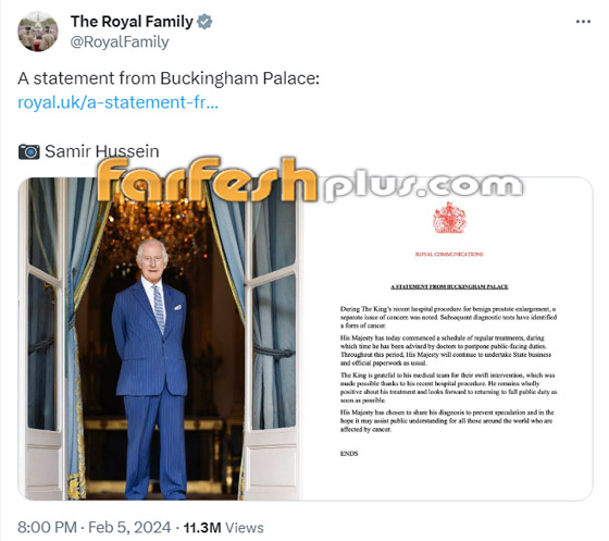 القصر الملكي يعلن إصابة الملك تشارلز بمرض السرطان ومعنوياته مرتفعة صورة رقم 6