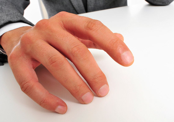 علماء يعتقدون أن طول الأصابع يكشف جانبا من السمات الشخصية! صورة رقم 3