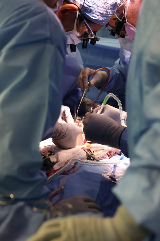 فيديو: جراحون أمريكيون يزرعون كلية خنزير معدل وراثيا لمريض حي صورة رقم 1