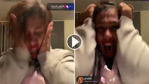 فيديو صادم: مشهورة كويتية تفقد أعصابها بجنون وتضرب نفسها وتشد شعرها ببث مباشر!