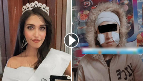 فيديو وصور مؤسفة: شاب يشوه وجه جارته ملكة الجمال المصرية بـ25 غرزة!